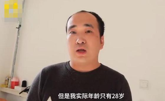 探究青少年禿頭現(xiàn)象，一個16歲男孩的故事與背后的思考，青少年禿頭現(xiàn)象探究，一個16歲男孩的故事引發(fā)深度思考