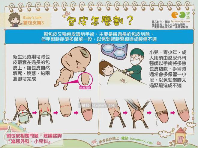 包莖手術(shù)痊愈時(shí)間探究，包莖手術(shù)痊愈時(shí)間解析