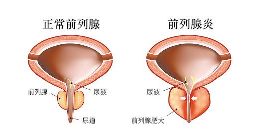 yanghuiwen 第22頁