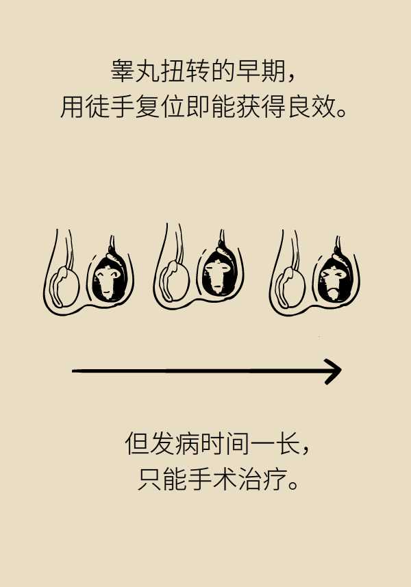 關(guān)于睪丸越來越小的原因分析及應(yīng)對建議，關(guān)于男性睪丸縮小的原因分析及應(yīng)對建議（非色情內(nèi)容）