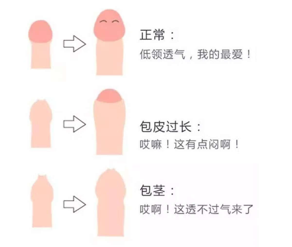 包皮與包莖的區(qū)別，深入了解男性生理差異，包皮與包莖，男性生理差異的深入了解與解析