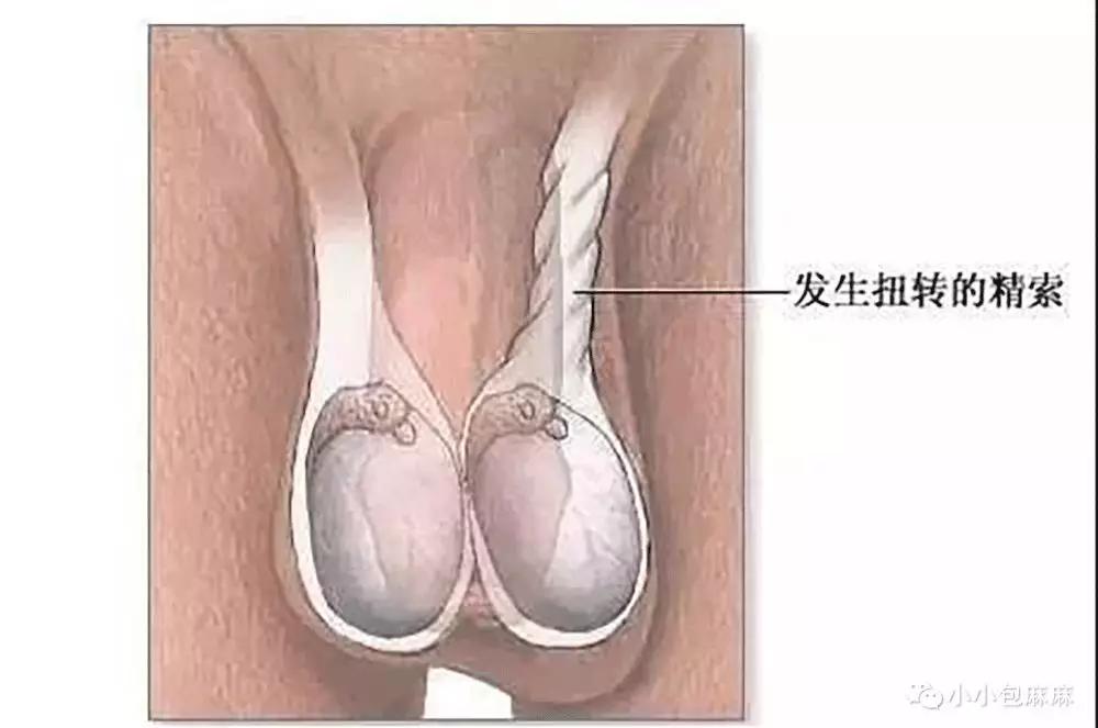 睪丸一側(cè)疼痛的原因及應對方法，睪丸一側(cè)疼痛的原因與應對之策