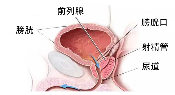 普樂安片治療前列腺炎的療程與效果，深度解析，普樂安片治療前列腺炎療程與效果深度解析，療程長短與治療效果一覽無余。