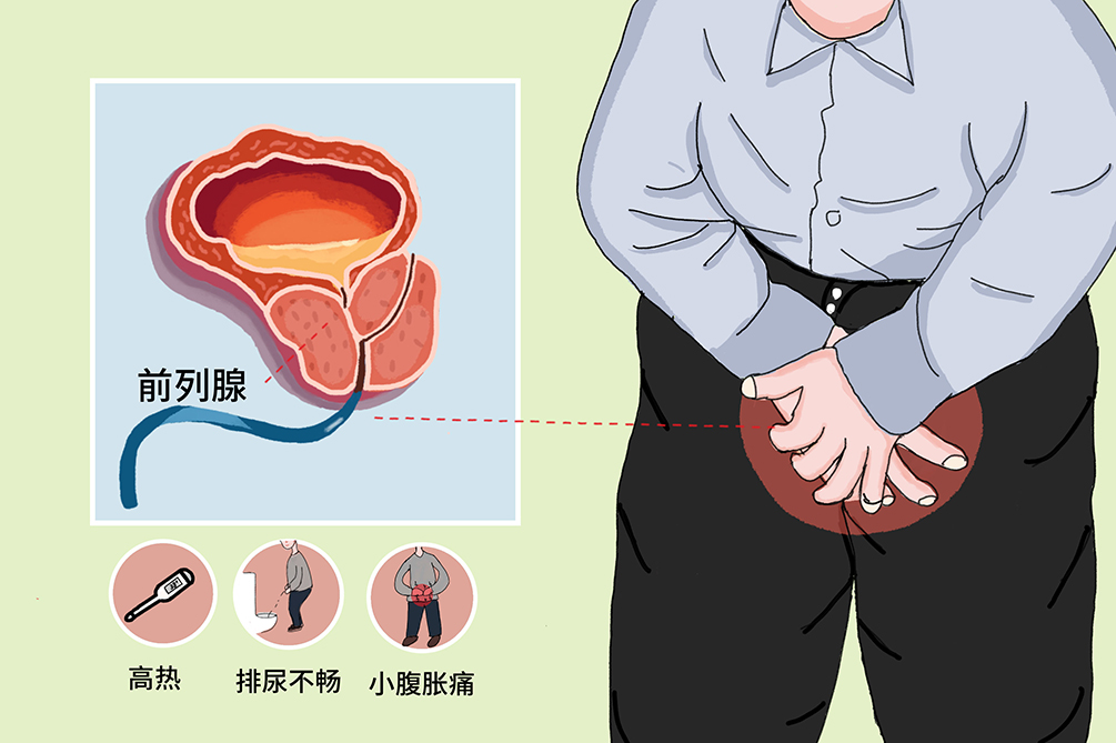 前列腺炎的緩解方法，了解、預(yù)防與改善，前列腺炎緩解方法，了解、預(yù)防與改善措施