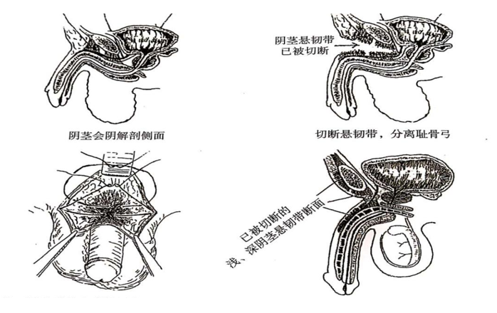 男性增大手術(shù)靠譜嗎？深度解析與探討，男性增大手術(shù)深度解析，可靠性與風(fēng)險探討